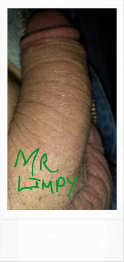 Limpy