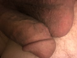 Gross deformed cock