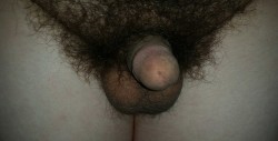 Biggest Clitoris
