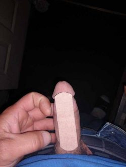 Need a bandaid 😂Nope but it looks like you’re in need of a cock…