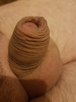 Shaving pubic hair around base of your penis doesn’t always work