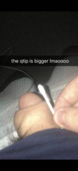 Acorn dick is smaller than a q-tip