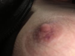Nipple