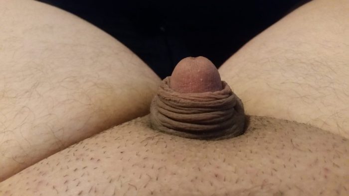 Extreme micro penis for sph
