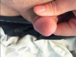 micro penis 2 inchs tiny balls