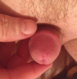 Expose Tiny Penis