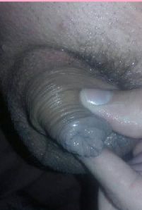 My small clit