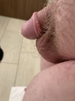 (Repin) A pathetic, useless micro clitty just like mine. It needs a good clean shave!