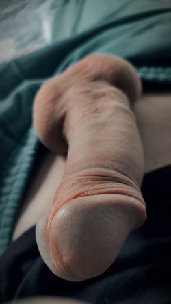 Dick