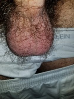 Hairy balls