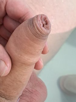 Bathtime …. gotta pull that foreskin back