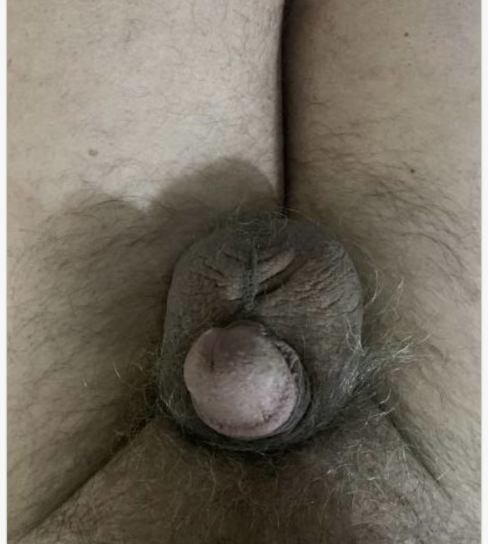 My hard cock