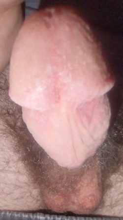 Please rate my 6 in. 22 year old cock