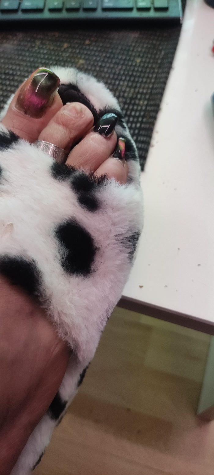 my polished toenails