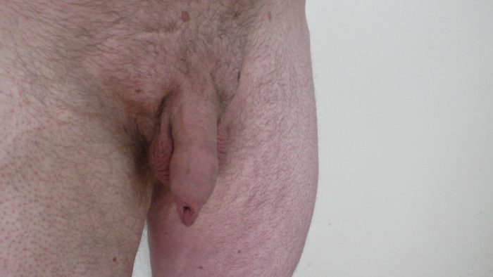 uncut dick