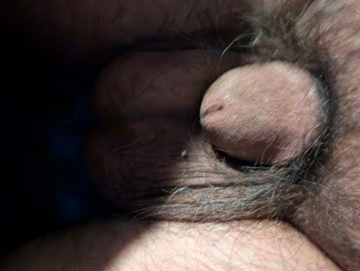 Head on and side view