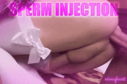 Sperm injection