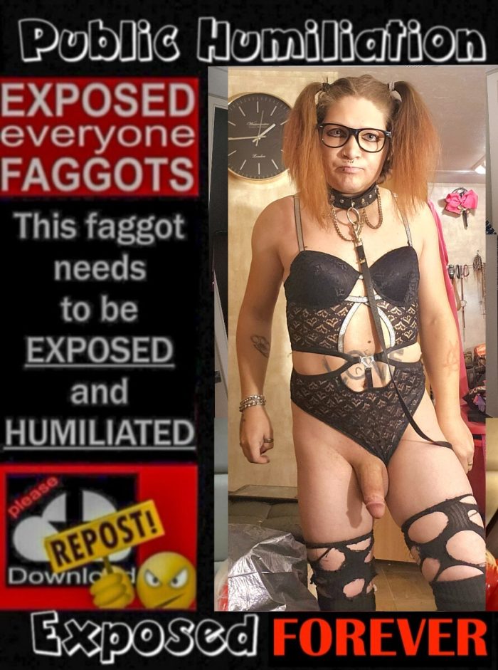 Exposure