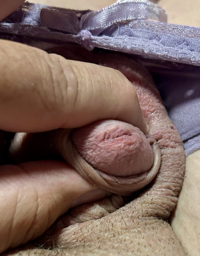 Tiny tiny