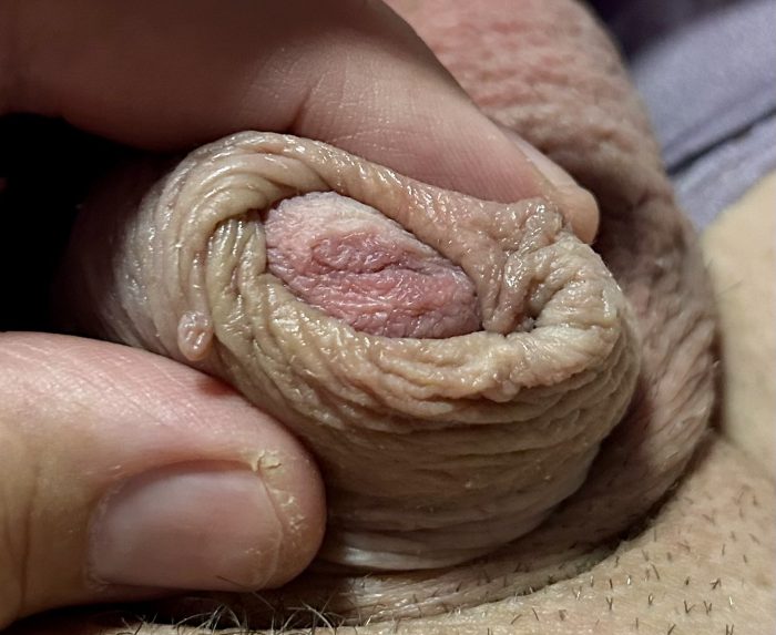 Tiny tiny