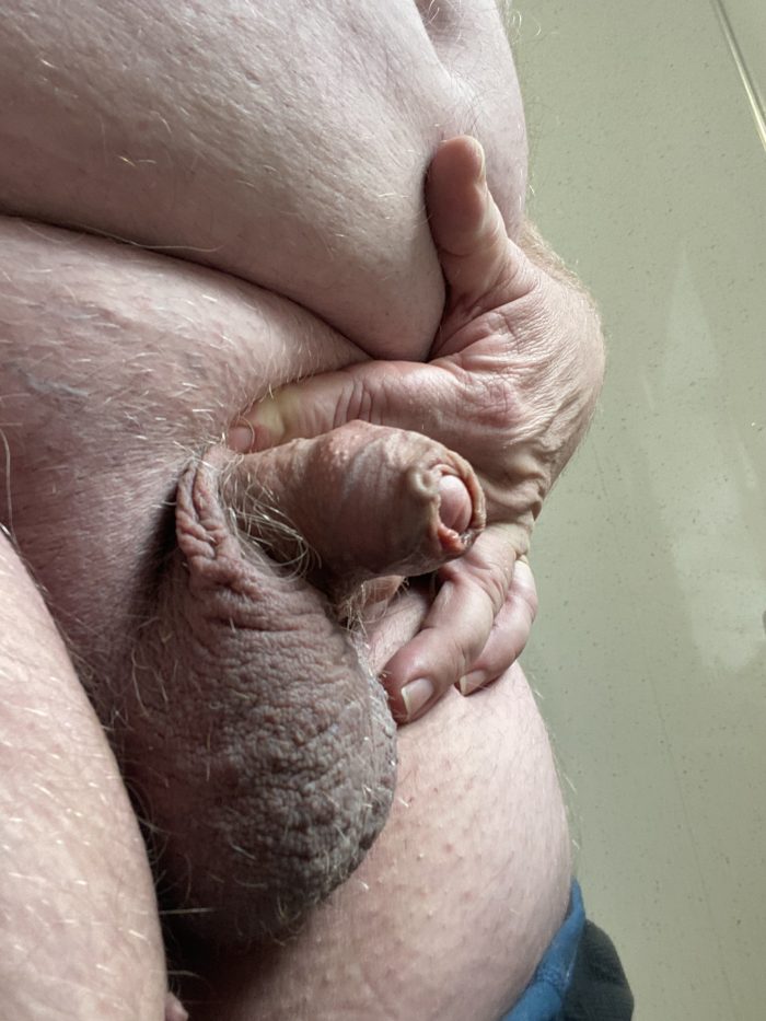 Innie to full erection