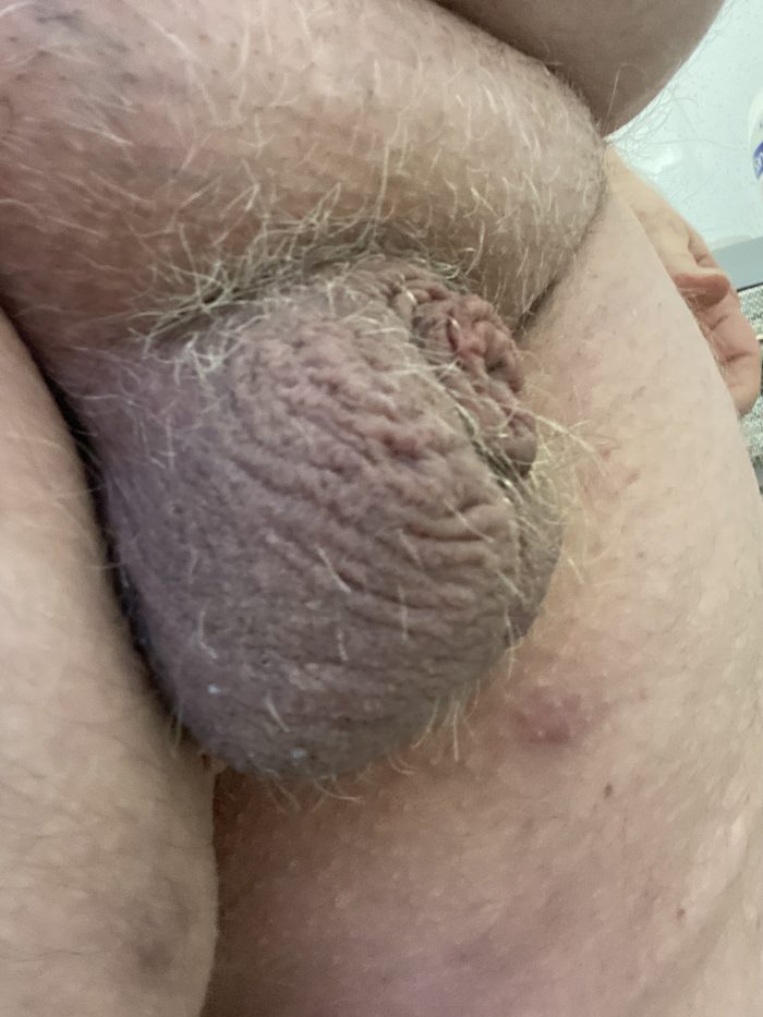 Waking up a Micro Dick
