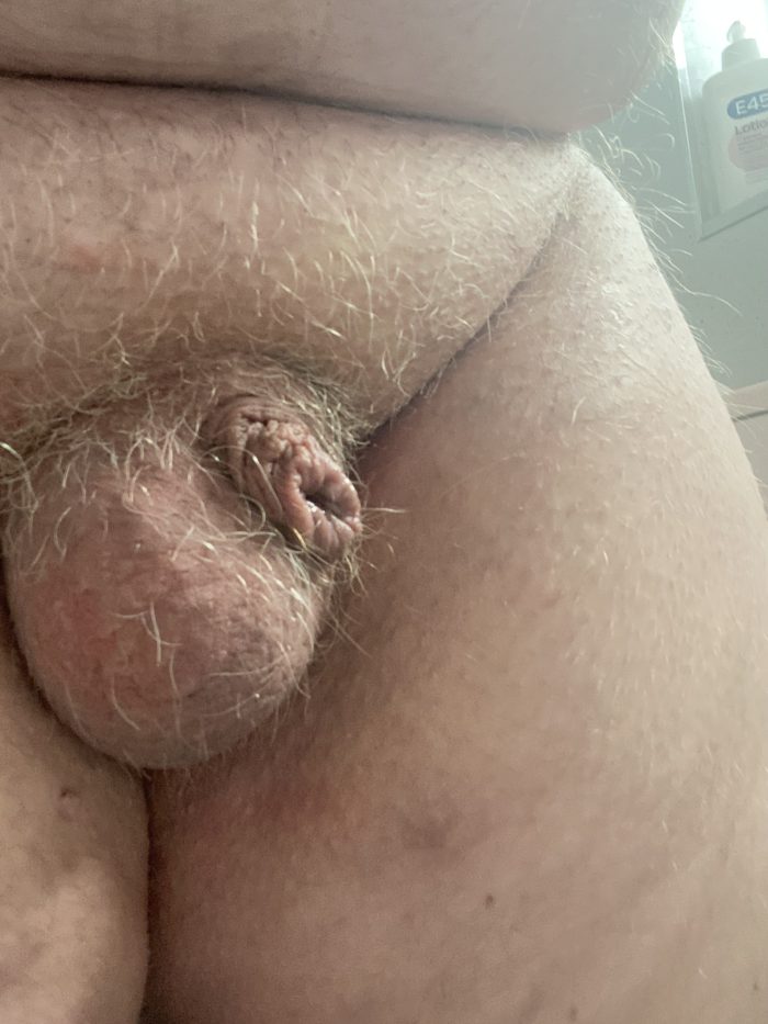 Balls and foreskin before my micro dick rises