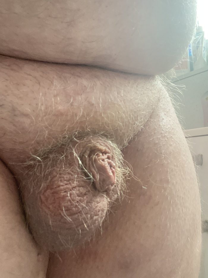 Balls and foreskin before my micro dick rises