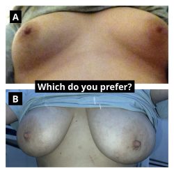 The choice is yours.