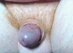 theredvik cock nude small little short micro penis dick from Canada webcam