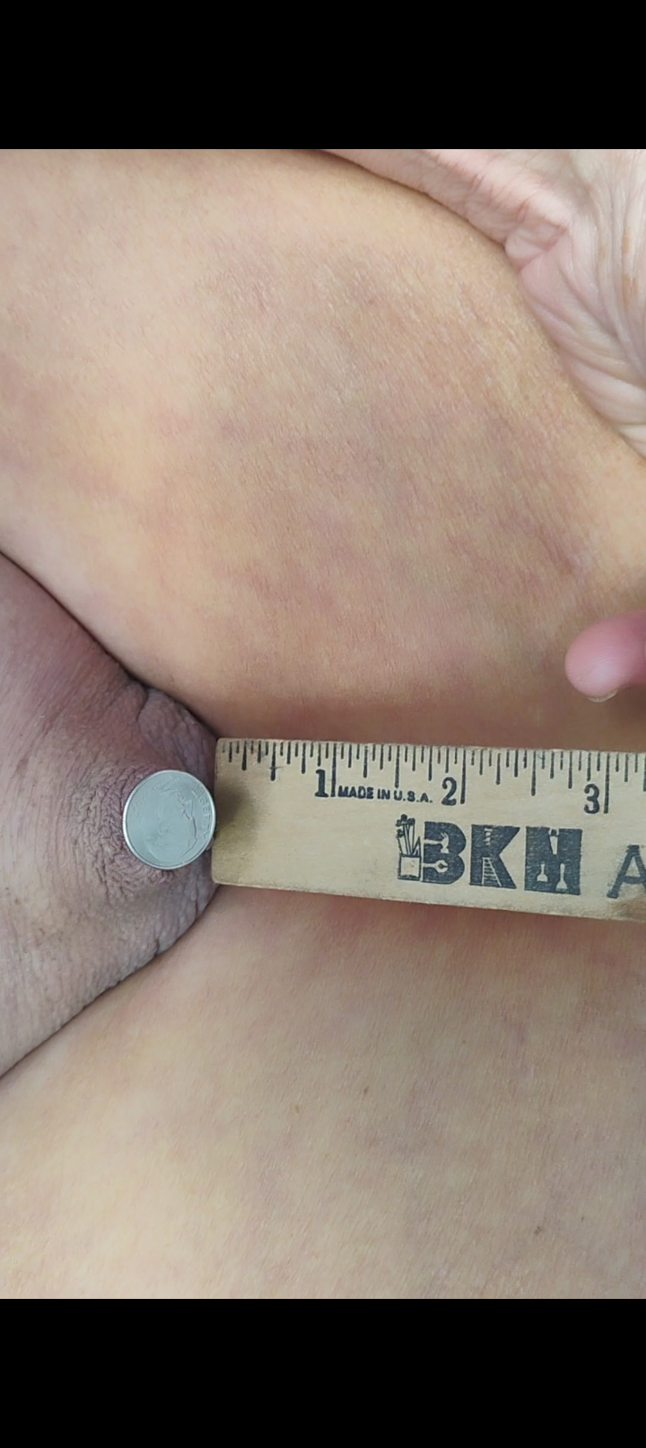 Dime sized quarter inch penis