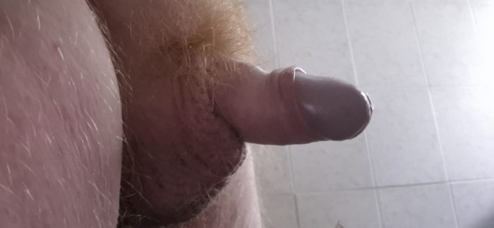 My penis pics