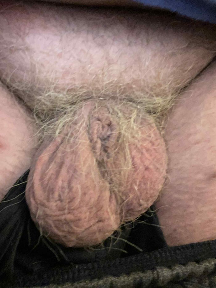 Where’s my dick gone ?