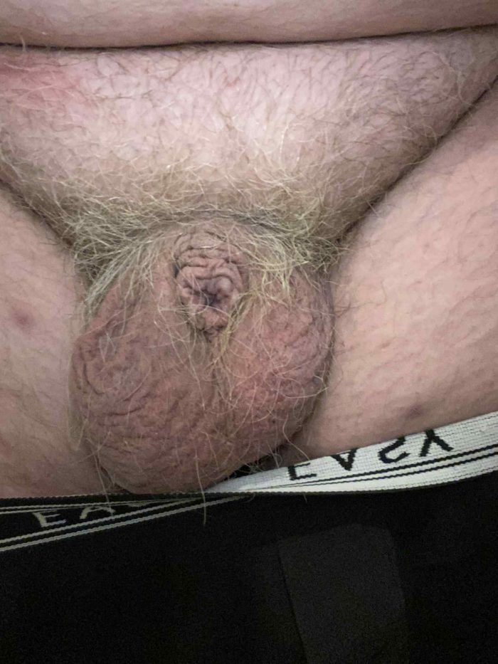 Where’s my dick gone ?